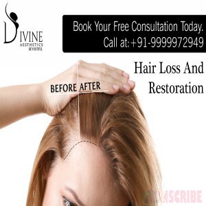 How Can Plastic Surgeons Treat Hair Loss And Restoration?